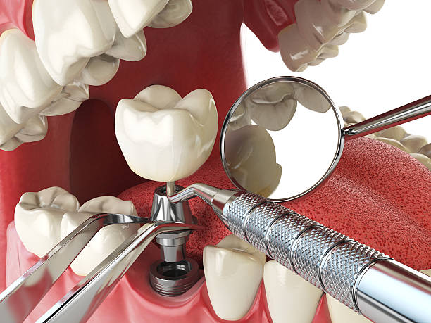 Best Broken or Chipped Tooth Repair in Carroll Valley, PA